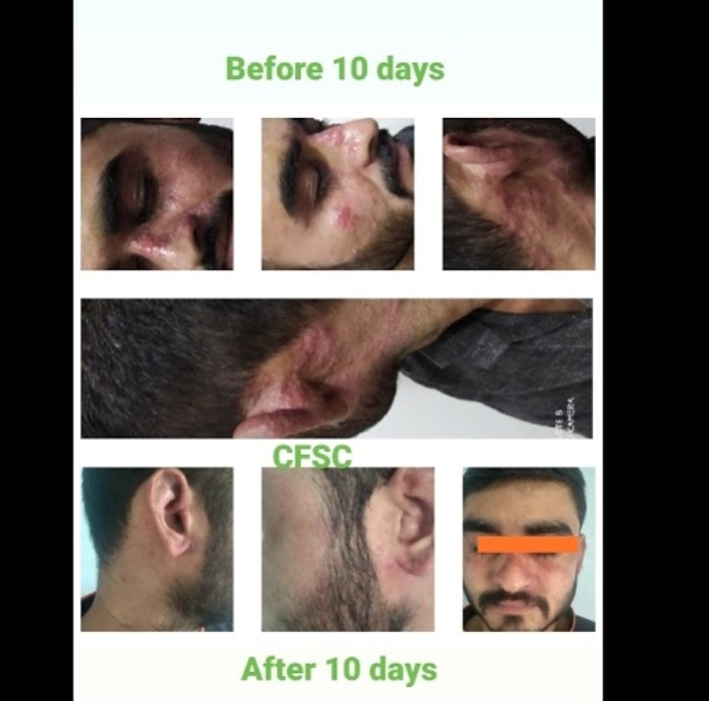 Before After Cosmetic Treatment